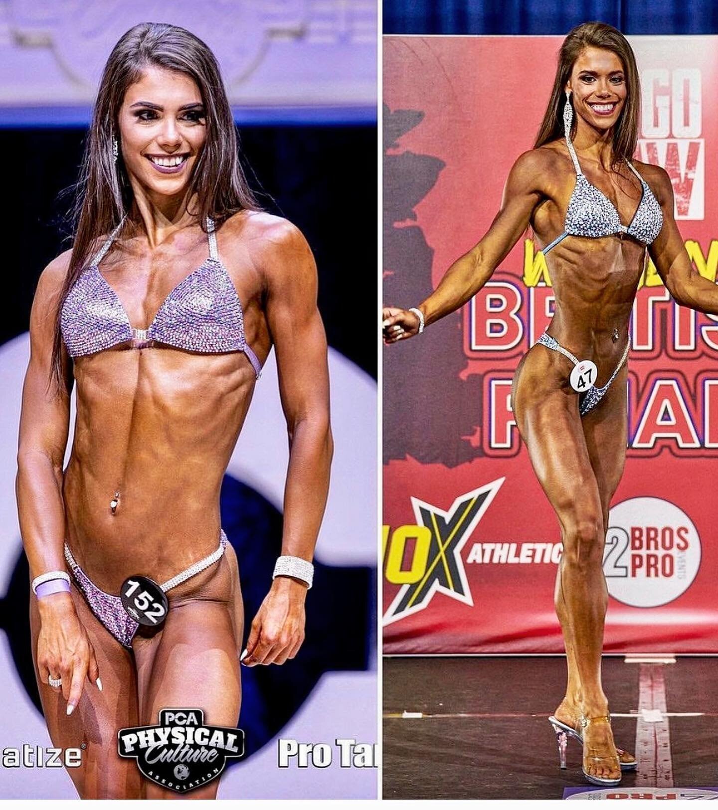 Invisalign transformation in time to smash the big competition for this very impressive lady! 🏆🏆🏆 #invisalign #bodybuilding #smiletransformation