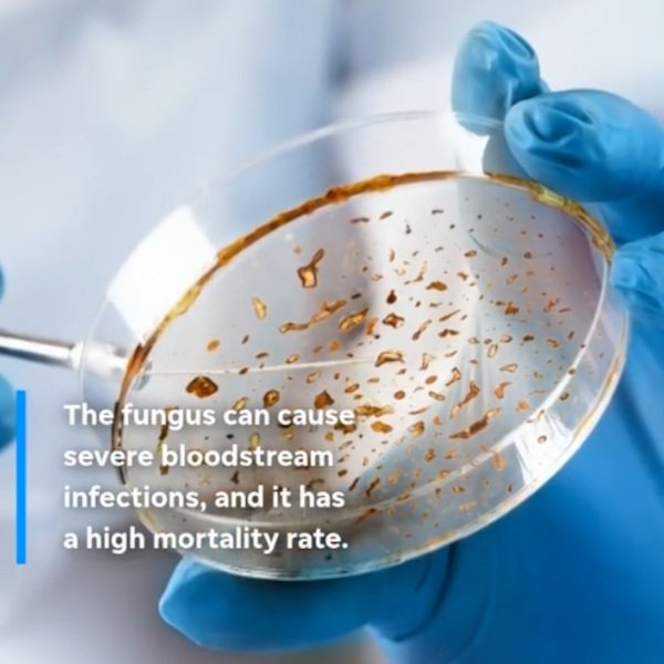Deadly drug-resistant ‘superbug’ is spreading in Washington state. What to know - tnt