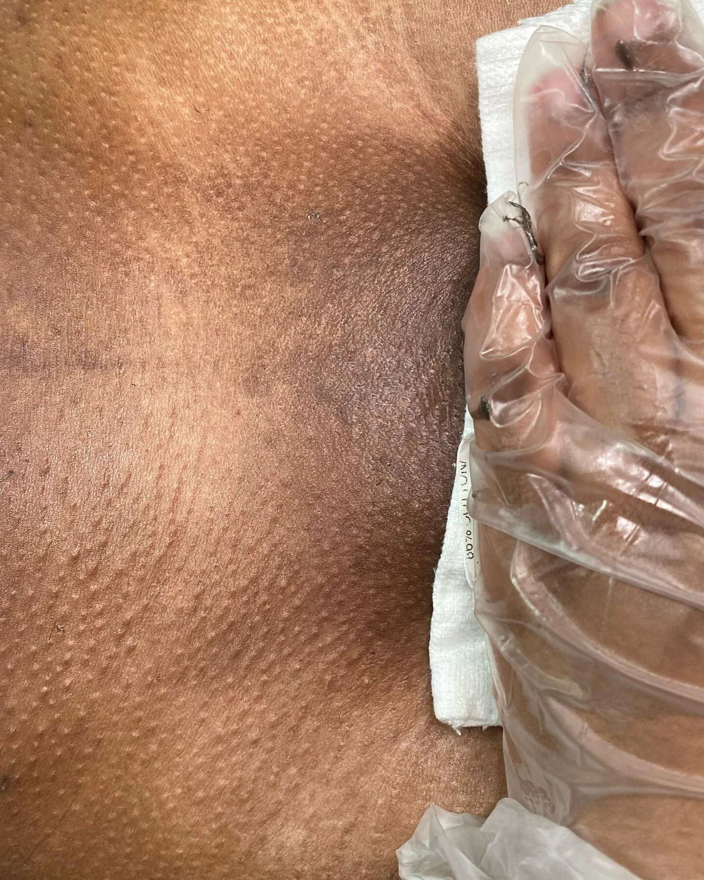 π Smooth Confidence for Everyone! πβ¨ Get ready to rock your confidence with our Male Brazilian Waxing services! Because feeling great in your skin knows no gender. ππ― Say goodbye to unwanted hair and hello to a new level of smoothness! πͺπ #Waxi