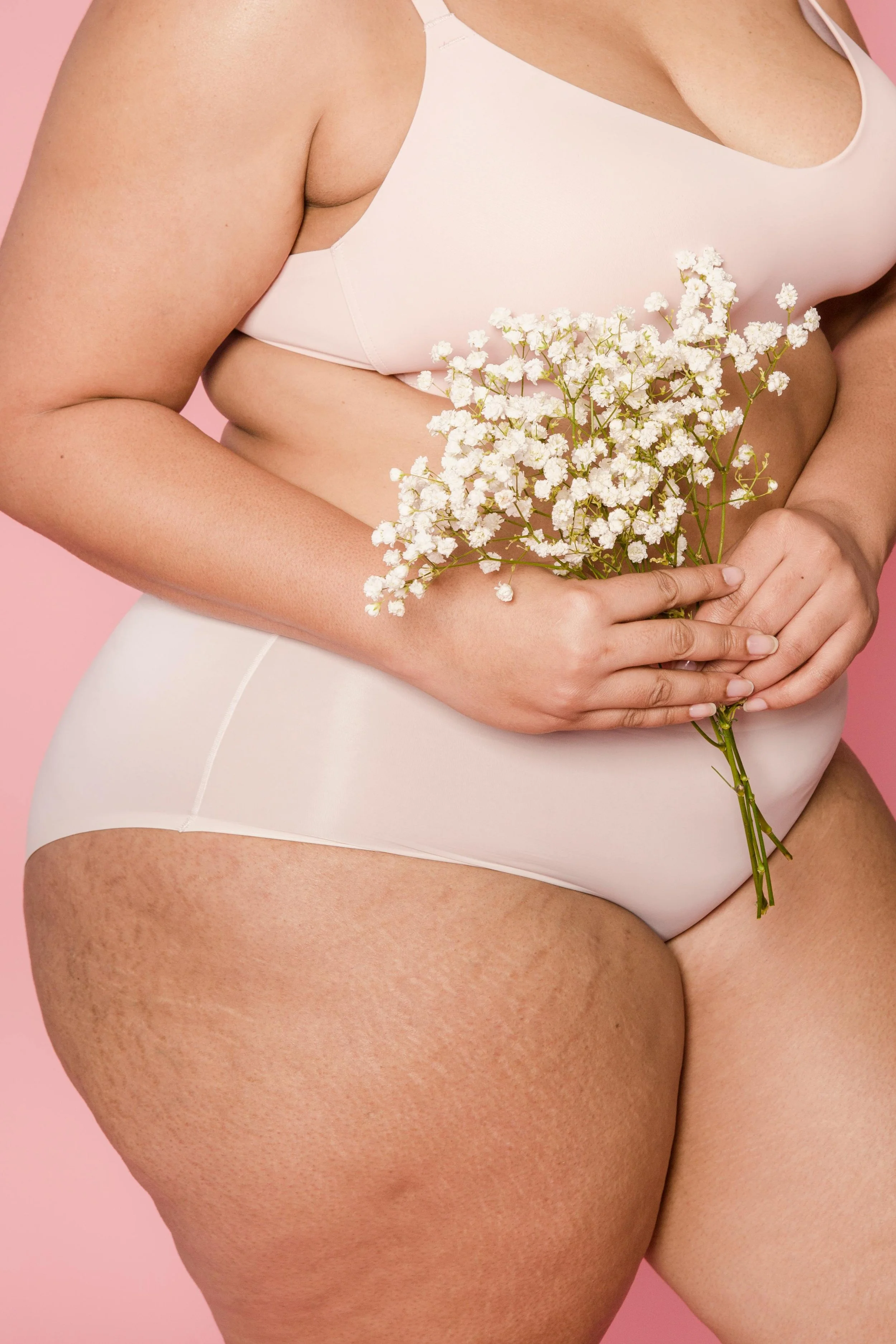 Stretch Mark Removal