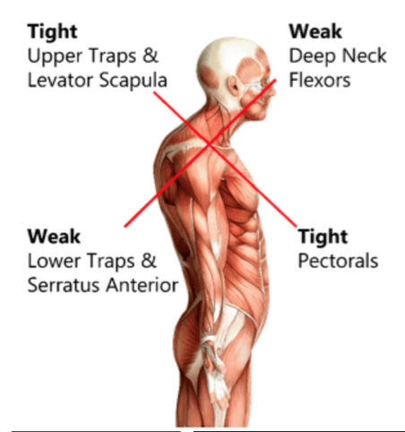 The Modern Shoulder - Desk Posture, Stability &amp; Injury Prevention