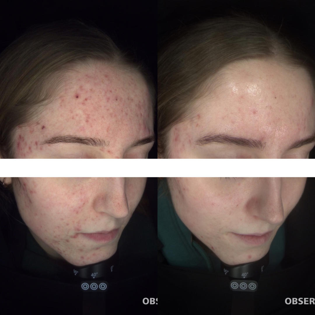 Untitled design 4.PNG