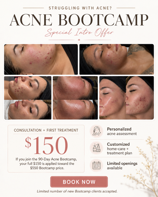 Acne facial palm harbor, florida