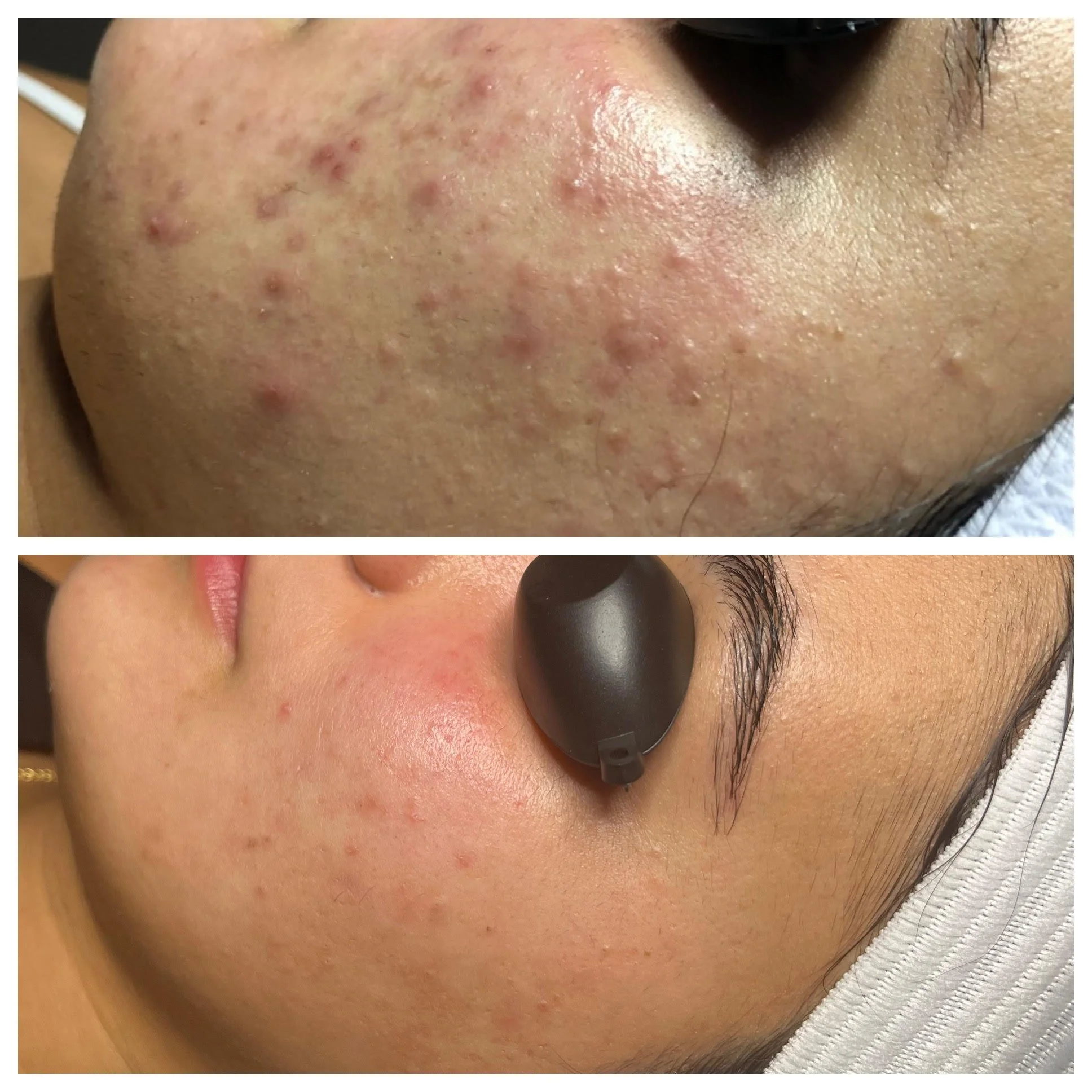Nat B&A.jpg