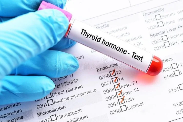 Comprehensive Blood Chemistry Test
