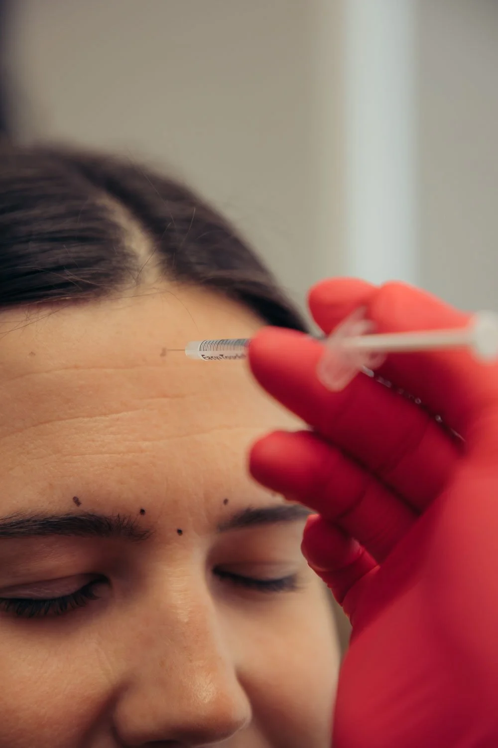 Close-up of a Daxxify injection being administered to the forehead — see Daxxify before and after results at our Arizona location.