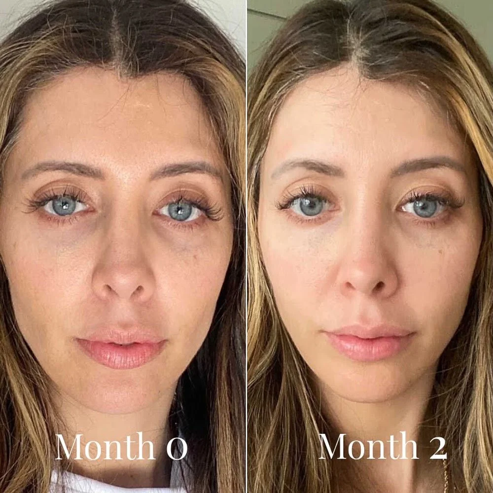 omnilux-contour-before-after.jpg