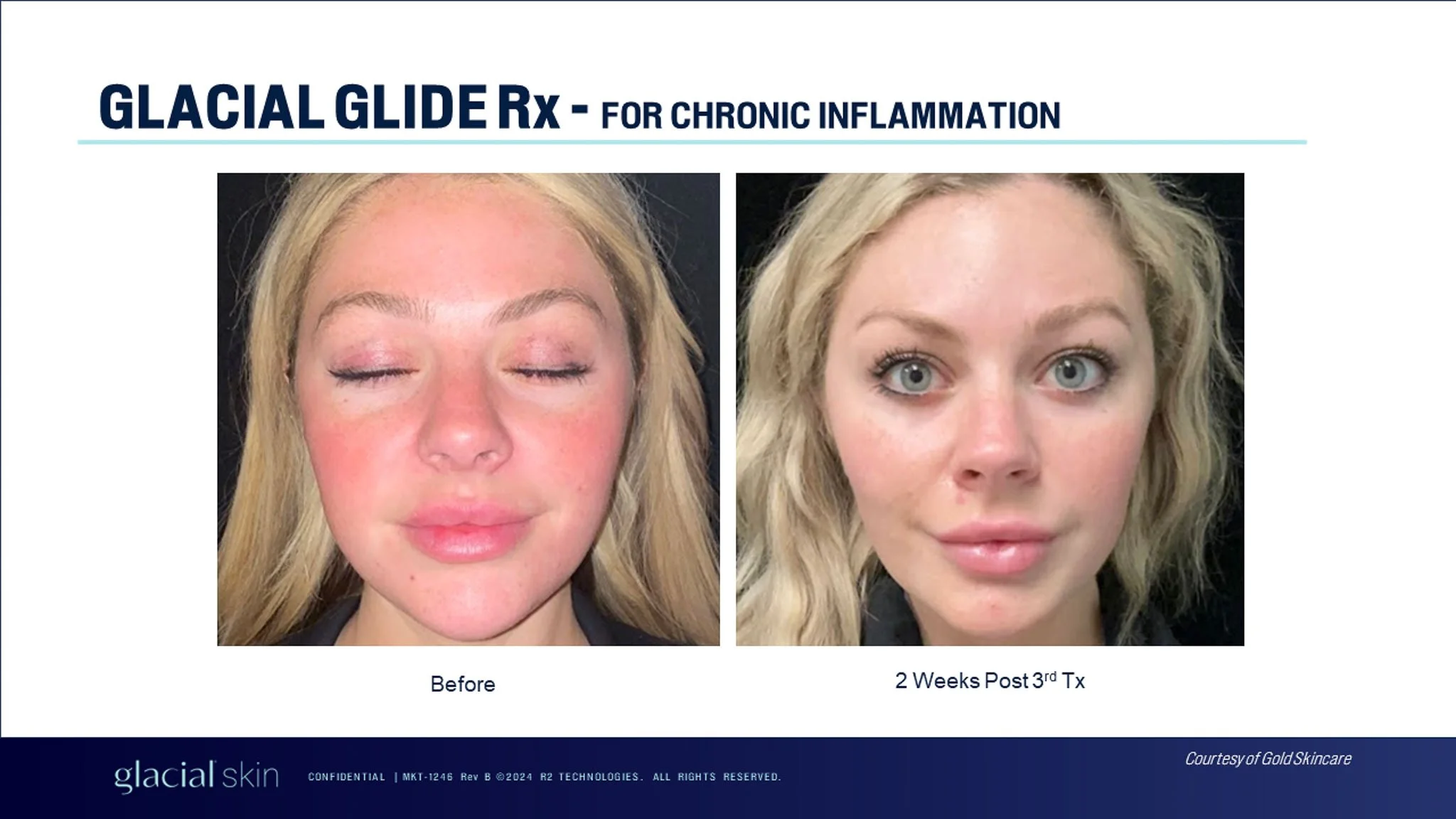  Before and after chronic inflammation in face. 