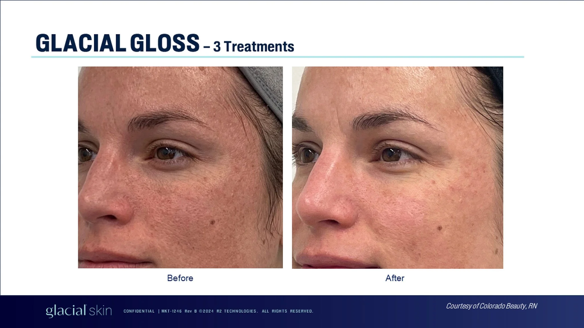 glacial-gloss-before-after-face.jpg