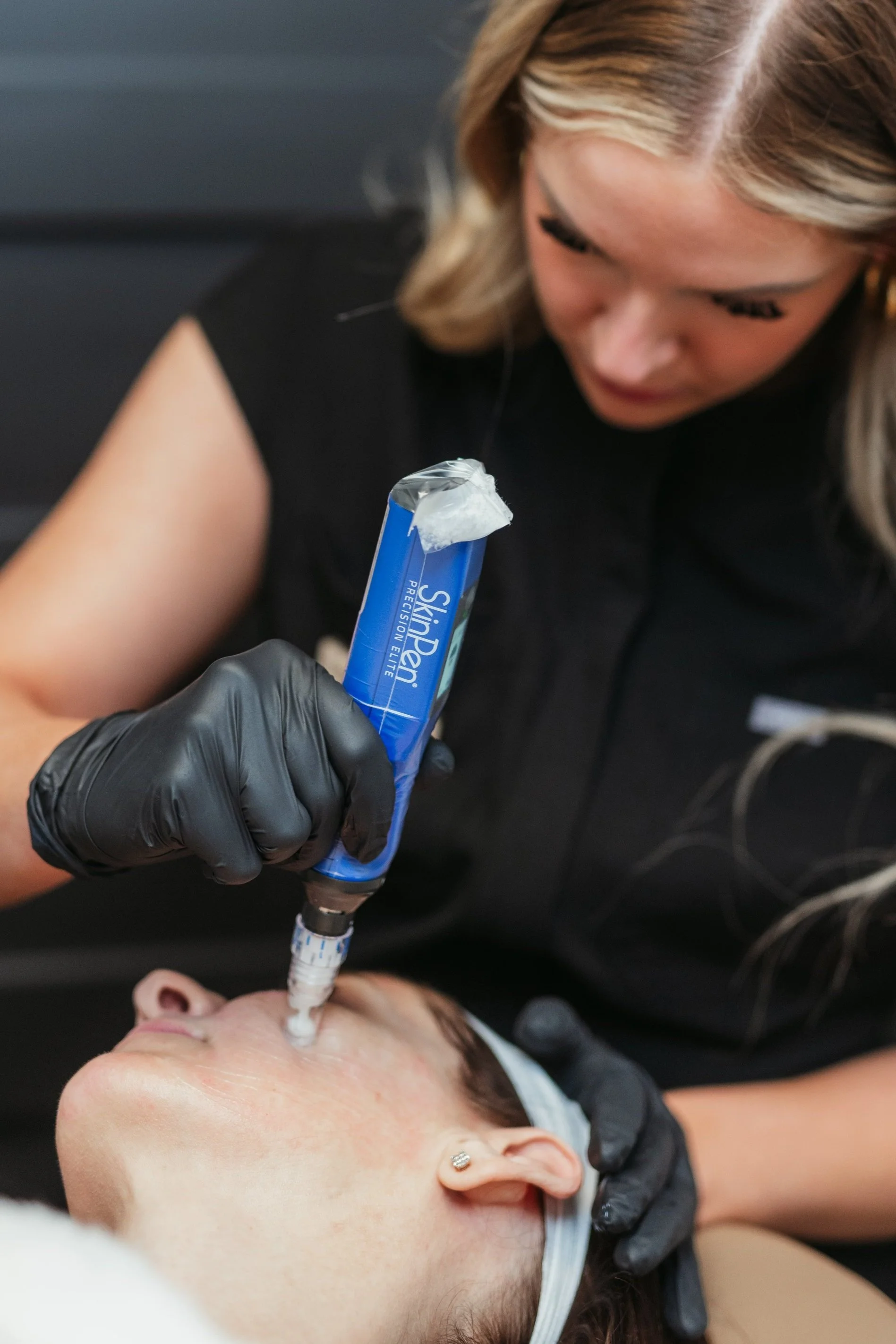 Microneedling treatment in North Peoria, AZ.