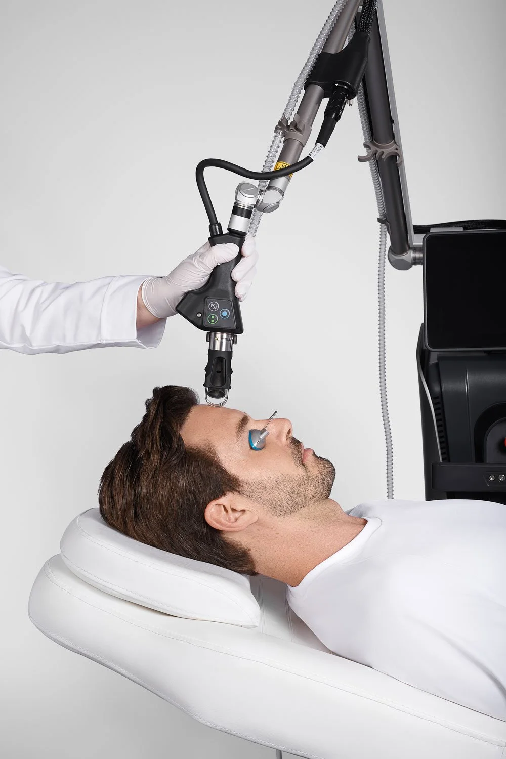 CoolPeel CO2 laser treatment in North Peoria, Arizona.