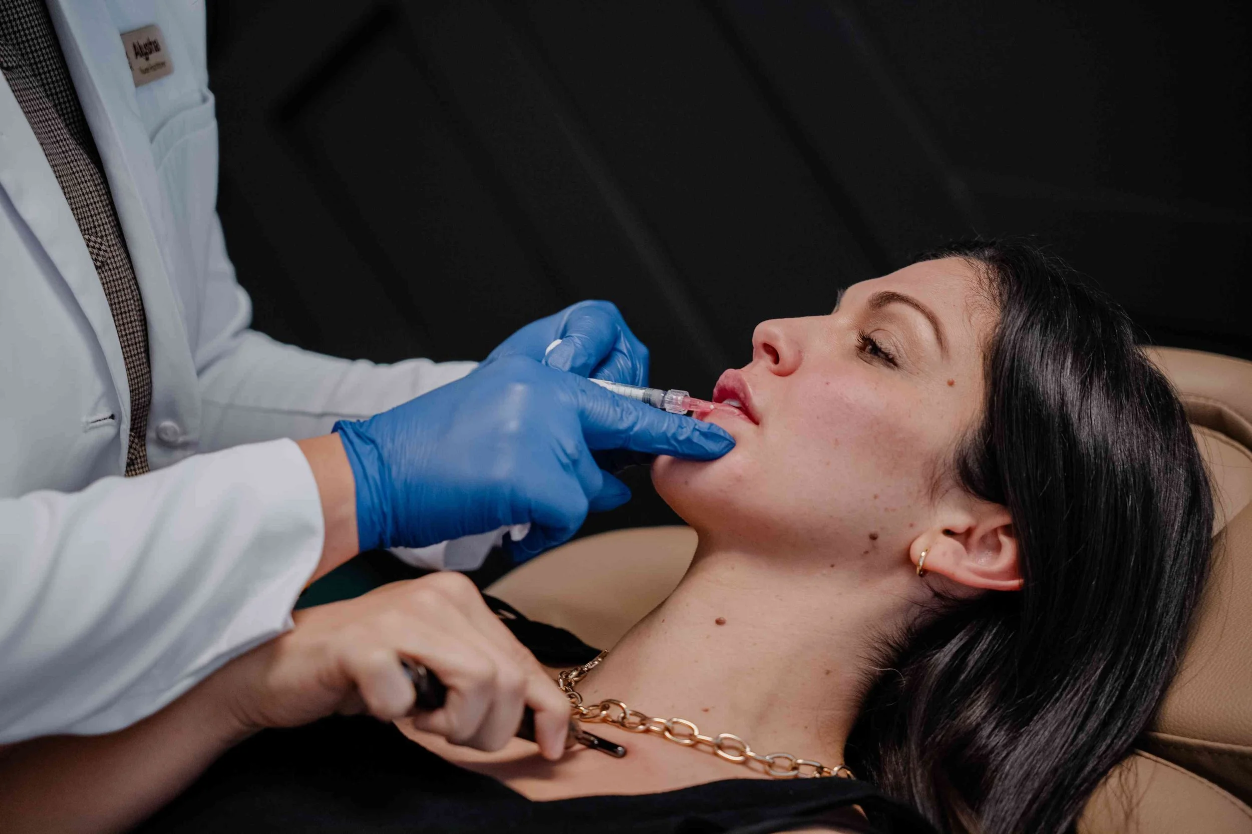 Provider in blue gloves injecting lip filler into a client's upper lip, a treatment offered by lip fillers near Peoria, AZ providers.