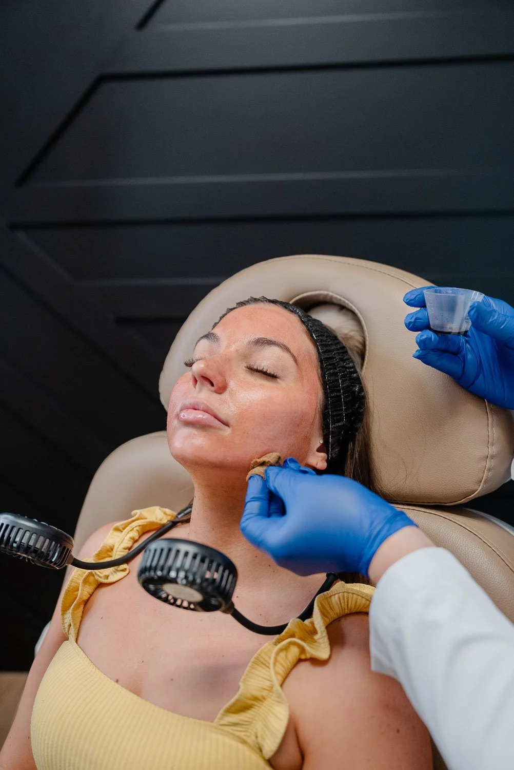 What is a VI peel: a licensed provider applying a medical-grade chemical peel solution to a patient's face at a Peoria AZ med spa.