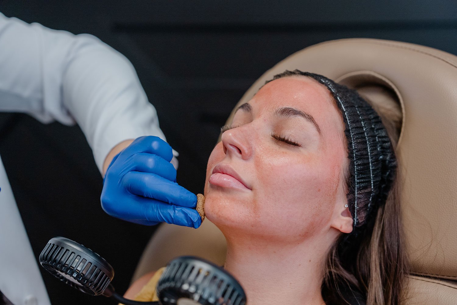 Close-up of a VI peel chemical peel being applied to a woman's face by a gloved provider at a med spa near Peoria AZ.