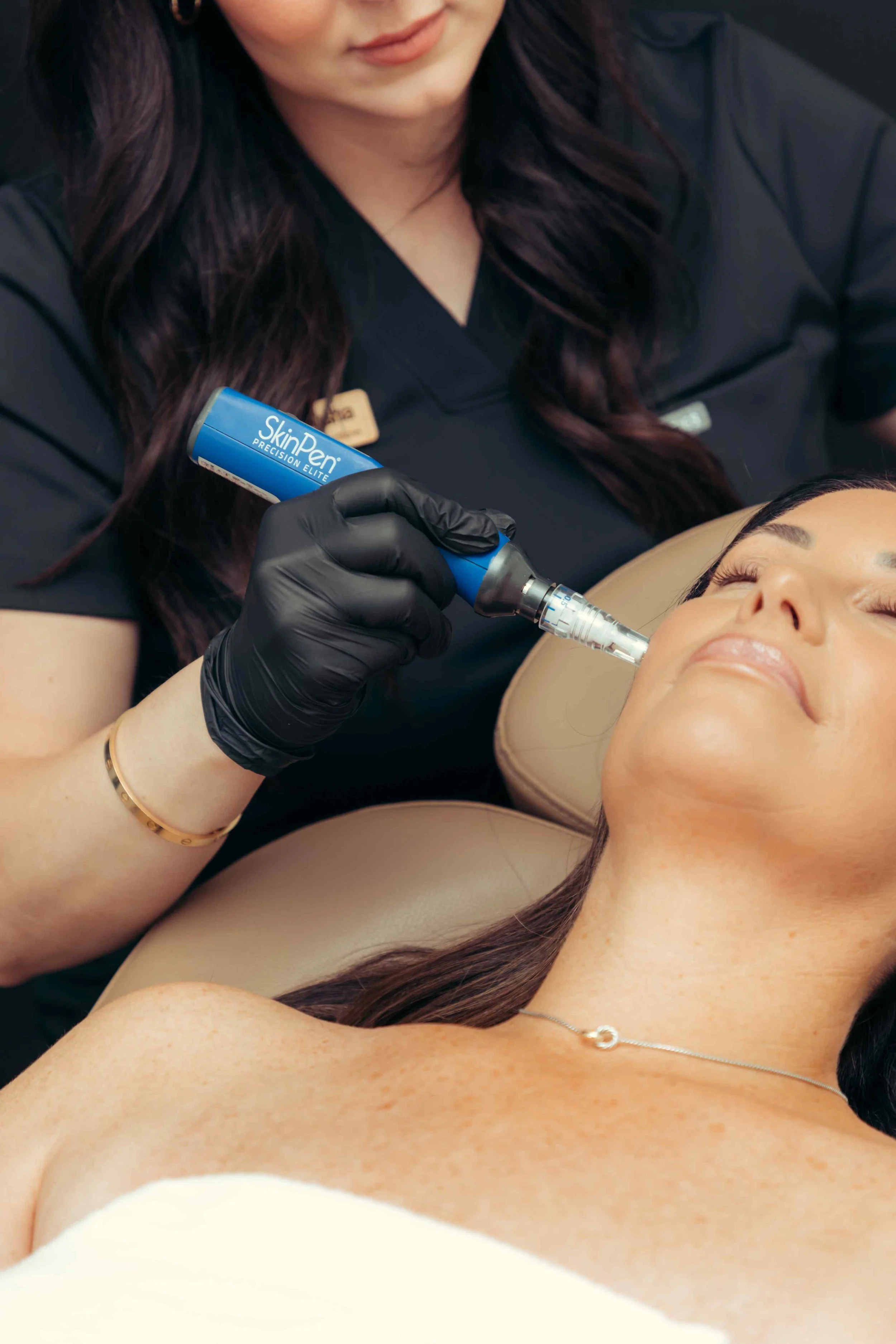 SkinPen facial microneedling in North Peoria, AZ.