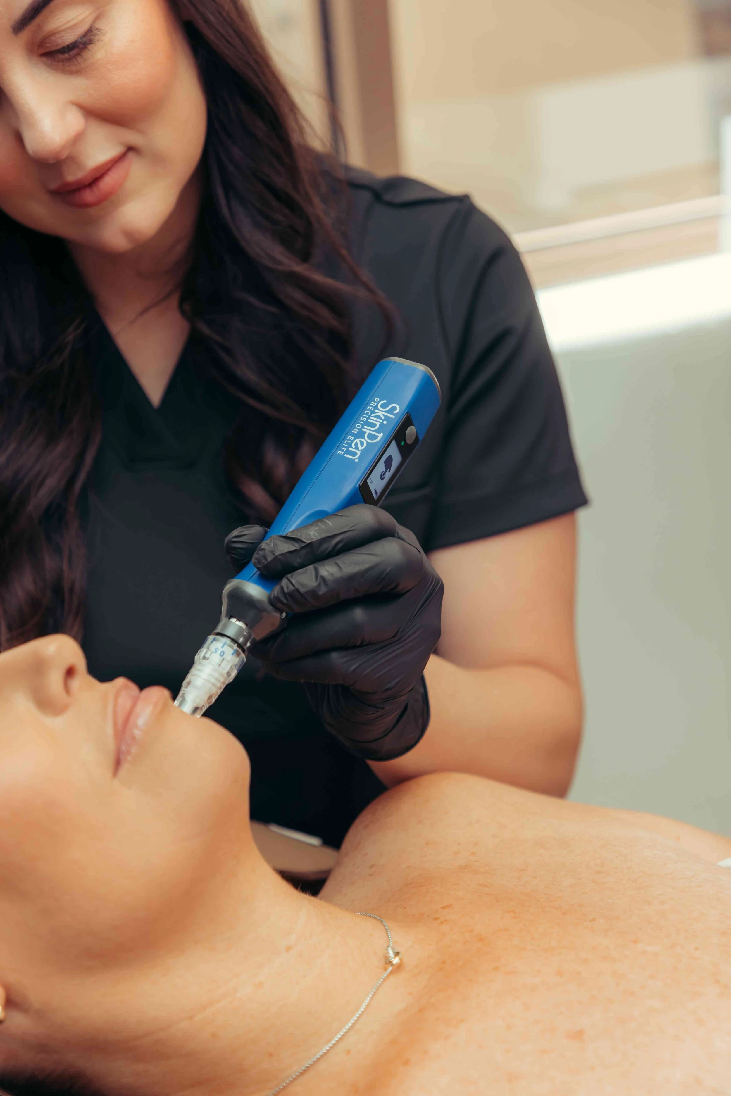 Microneedling on face and neck near Phoenix, AZ.