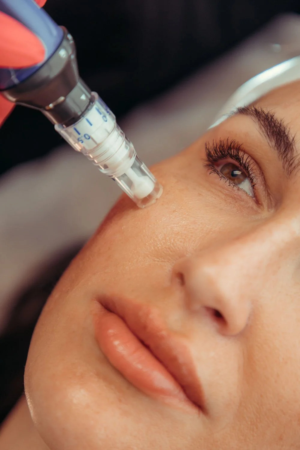 SkinPen microneedling treatments in Peoria,Az.