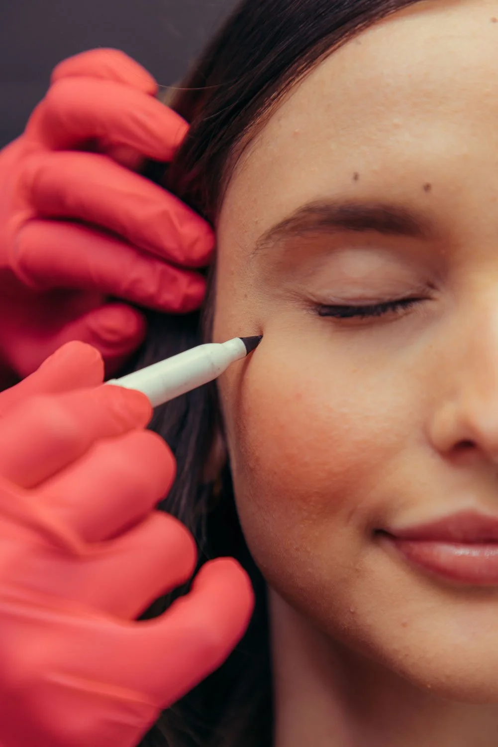 Close-up of a Daxxify injection being carefully administered near the eye area for precise wrinkle treatment.