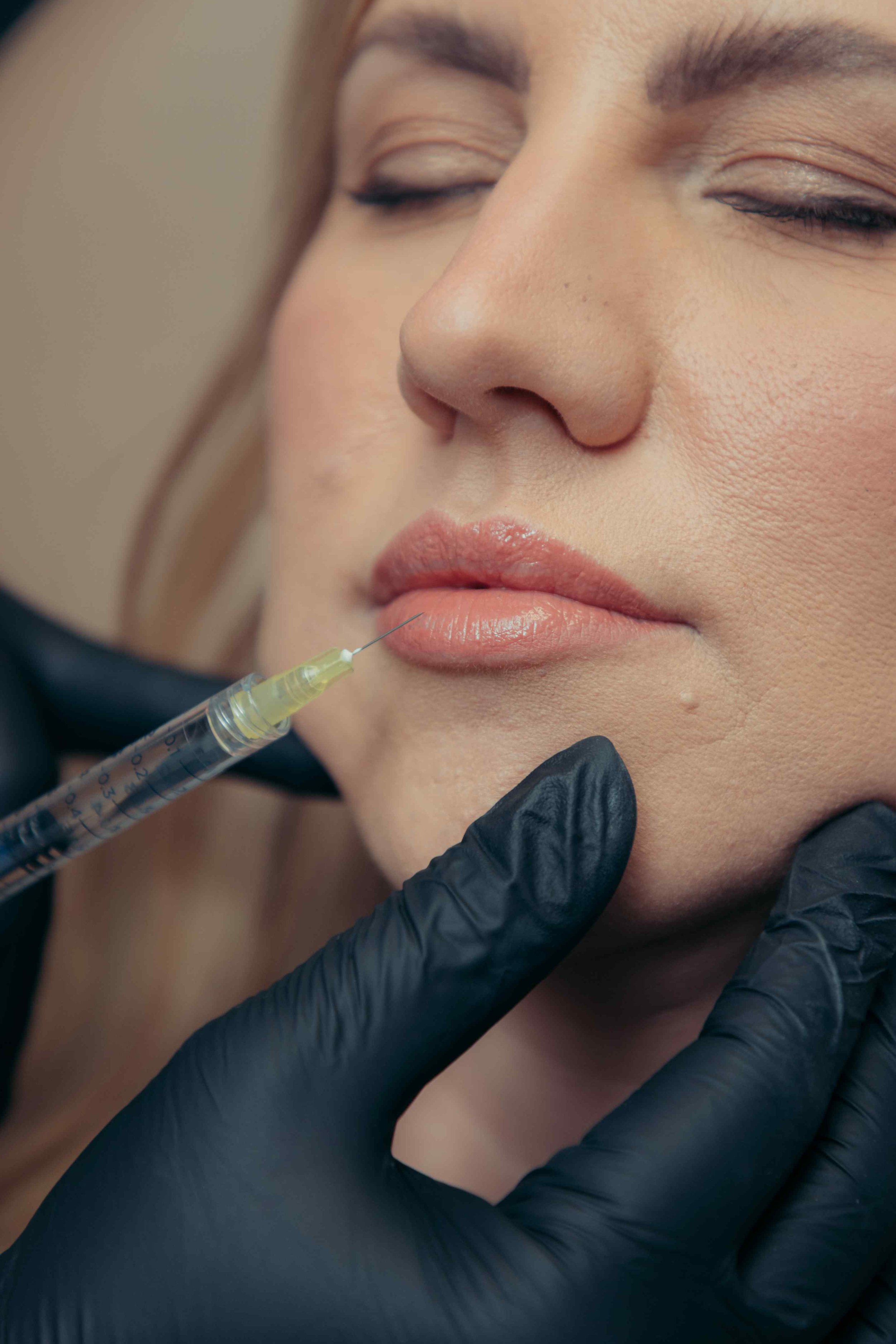 Extreme close-up of a lip filler injection, illustrating why working out after lip filler should wait 24 hours.
