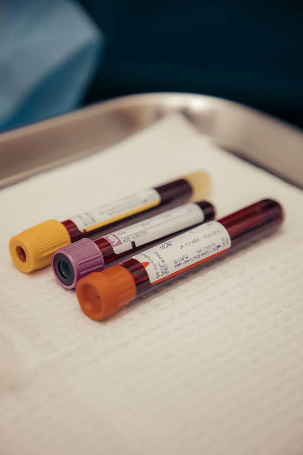 Lab Ordering and review of results in Peoria, AZ.