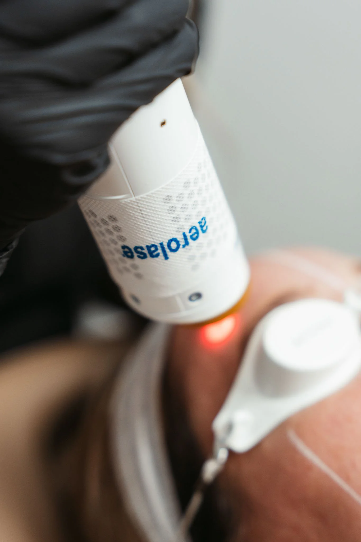 Laser treatment for scar removal near me.