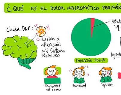 "Neuropatic Pain" Vídeo animado Visual Thinking