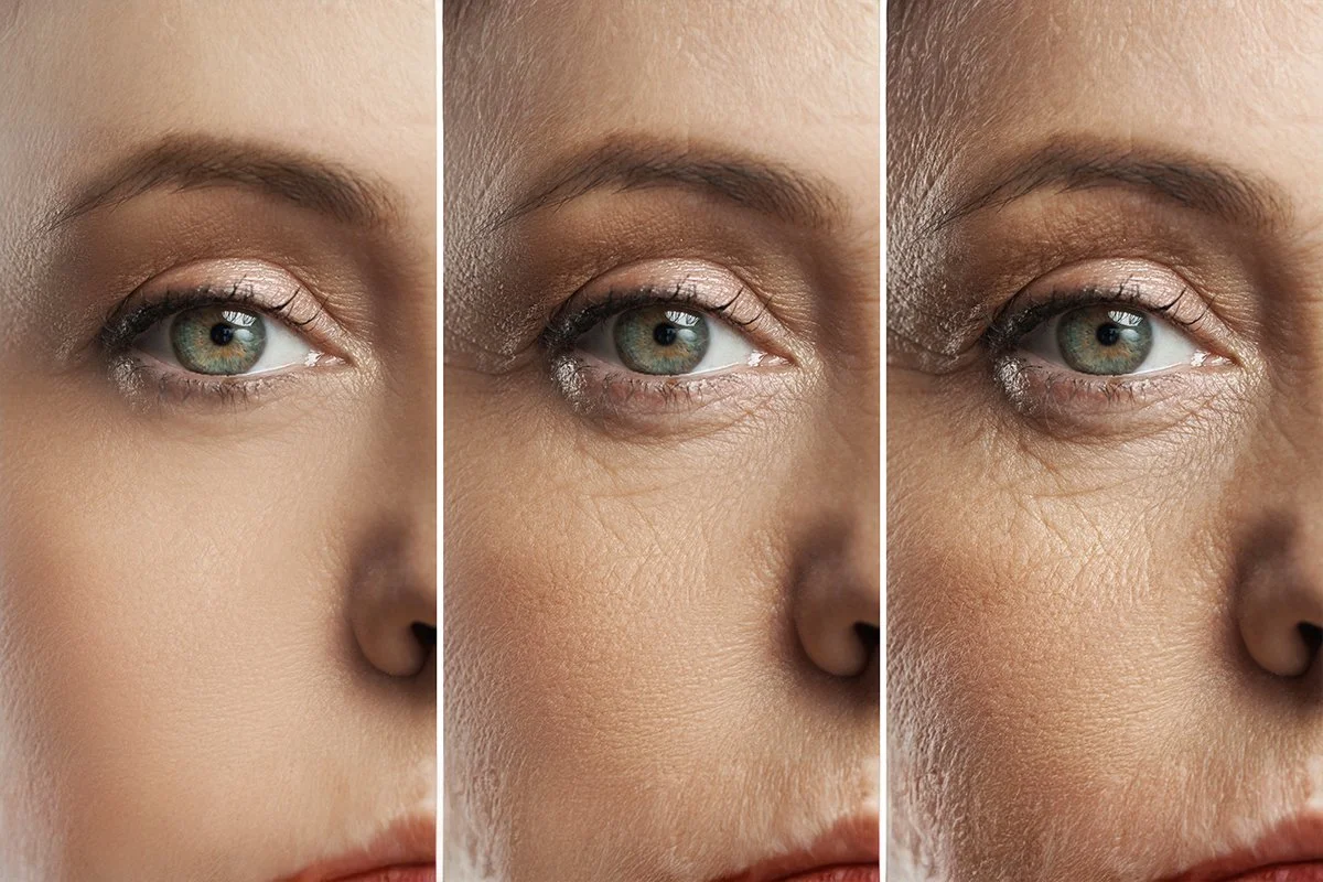 Glycation in Skin: What It Is and How to Treat It