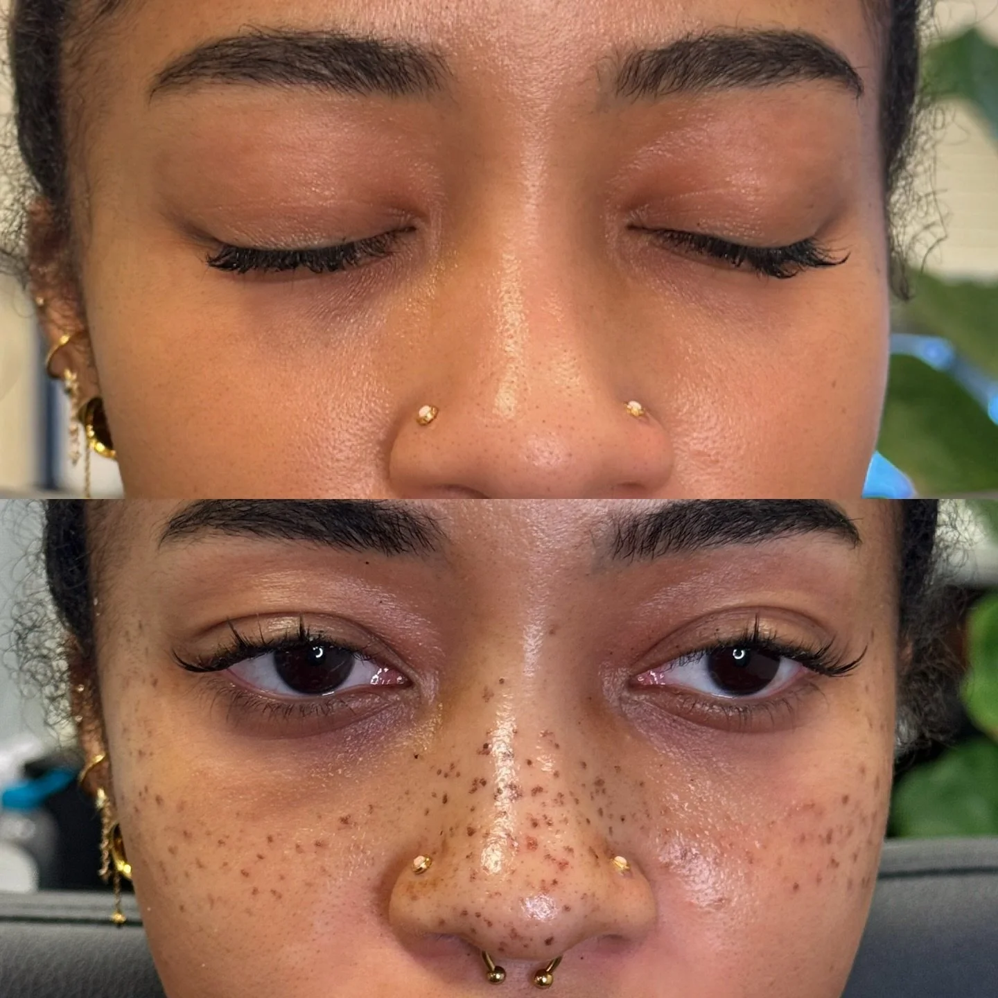1/2 sessions done 
Light to medium coverage freckles. 

The color with soften over the next few days. Producing the most natural results :) 

#freckles #frecklestattoo #facetattoo #pmufreckles #nova