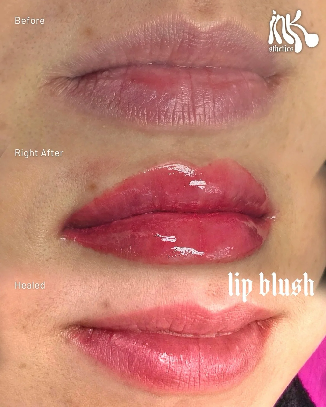 Here&rsquo;s what nobody tells you about lip blush, the color you see right after is not the color you keep. And that&rsquo;s a good thing.

Right after your appointment, your lips look bold and super pigmented (that&rsquo;s the freshly placed pigmen