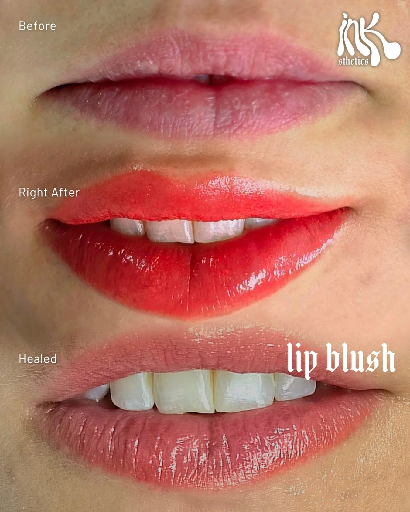 From color loss to color blush&hellip; that&rsquo;s the magic behind lip blushing. 💋

A soft wash of color, a fuller-looking shape, and that effortless flush that makes you look like you&rsquo;re already wearing your favorite lipstick (except you&rs