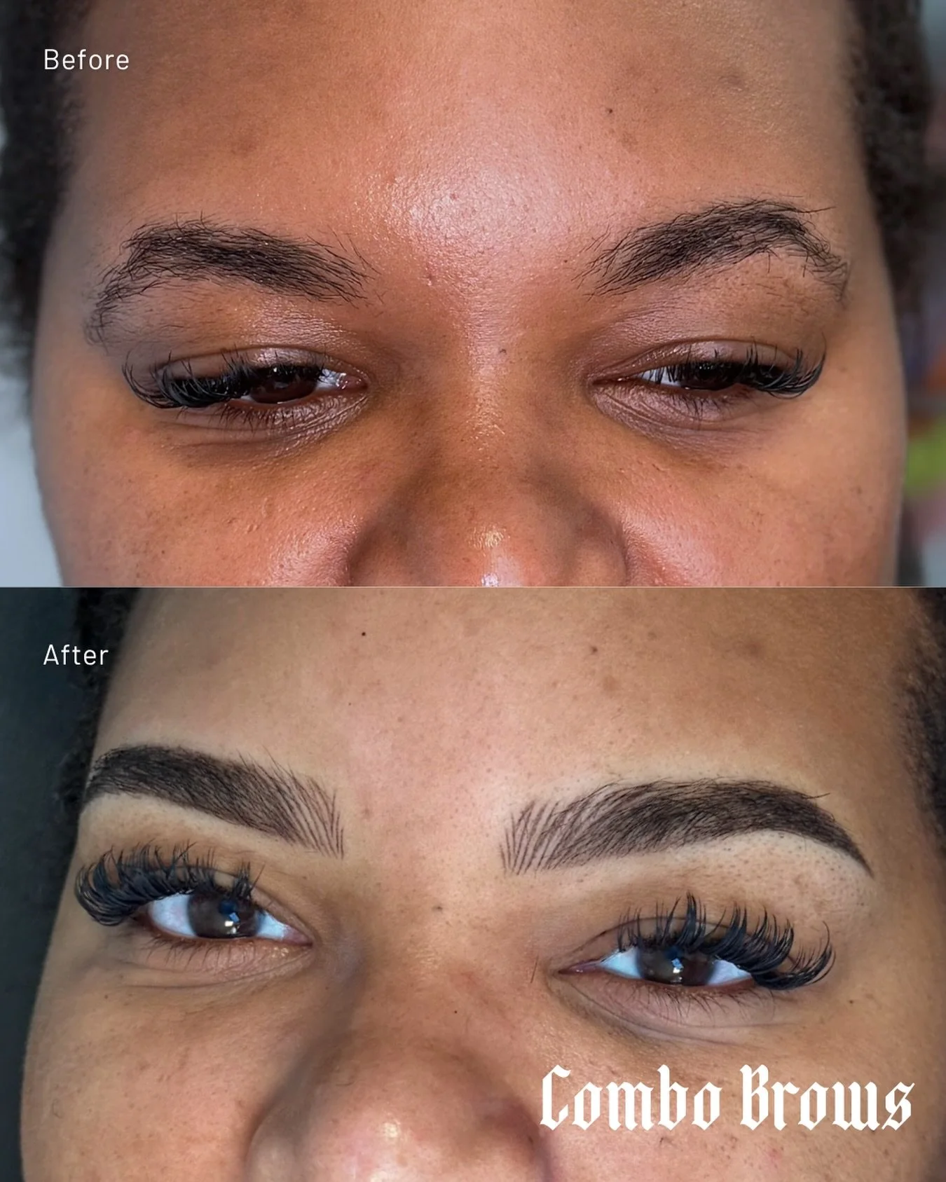Combo Brows are the perfect baby between powder brows and nano brows. ✨

The technique blends both worlds, we add hair-like strokes at the front of the brow to give it that real, natural effect, and then it softly fades into a powdery, shaded finish 
