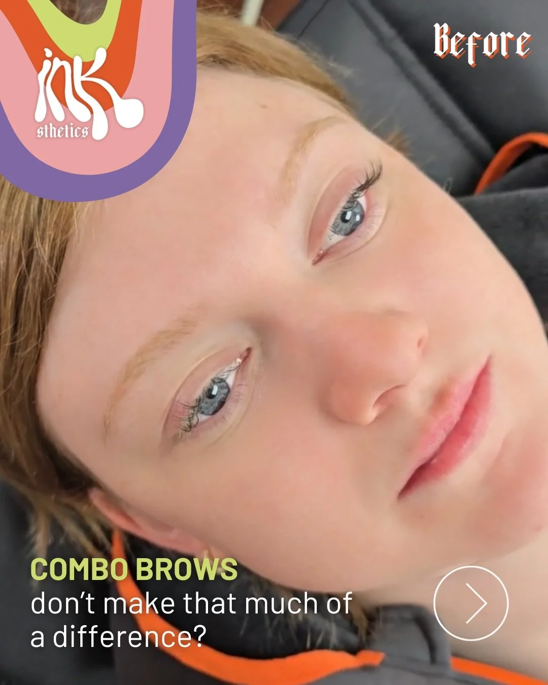 Combo brows are the perfect baby between nanobrows and powder brows.

You get the soft, powdery makeup-look finish of powder brows, paired with the crisp, hair-like strokes. 

The result? A natural-looking front that gradually blends into a beautiful