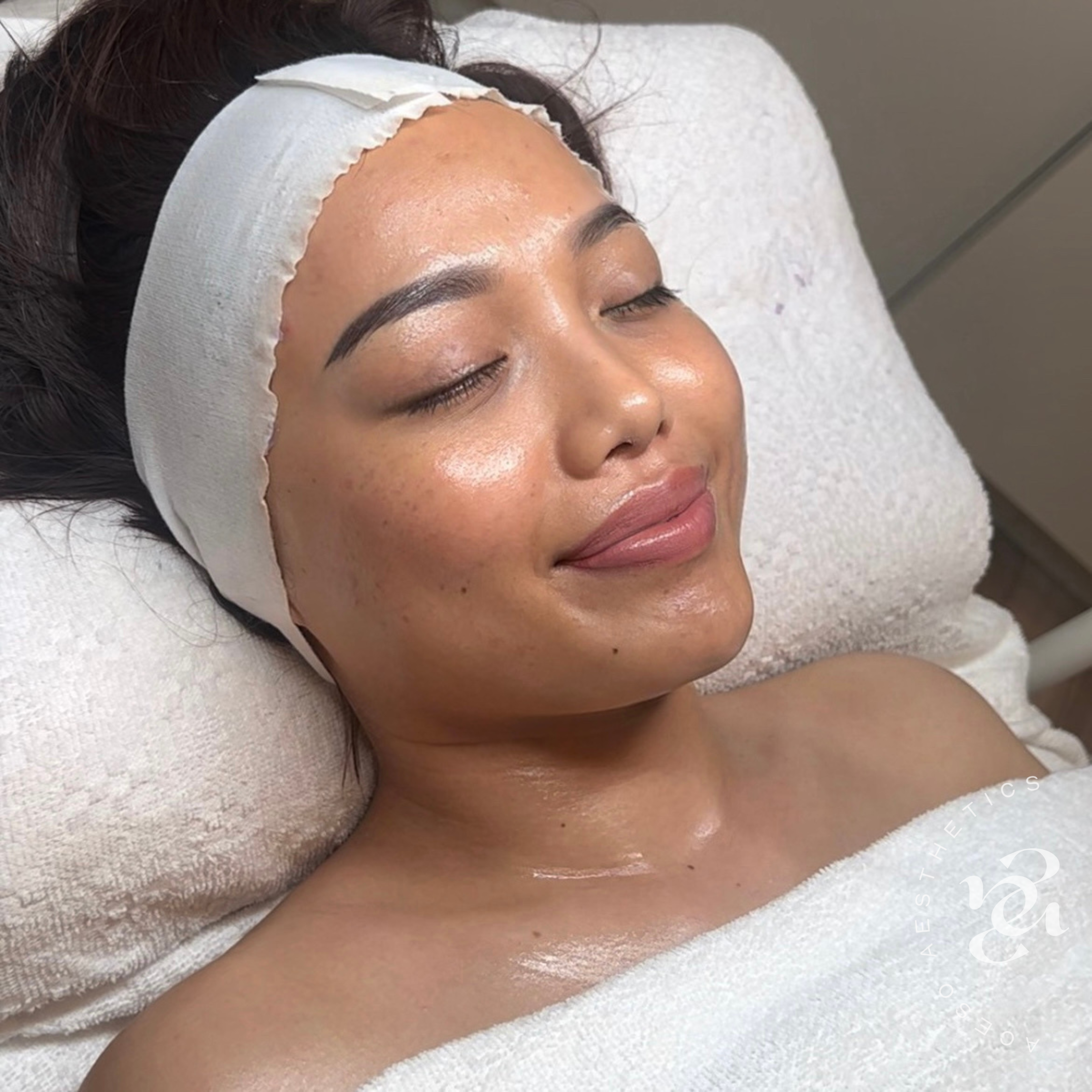 Facials Square post - with Aceso Logo - 20.PNG