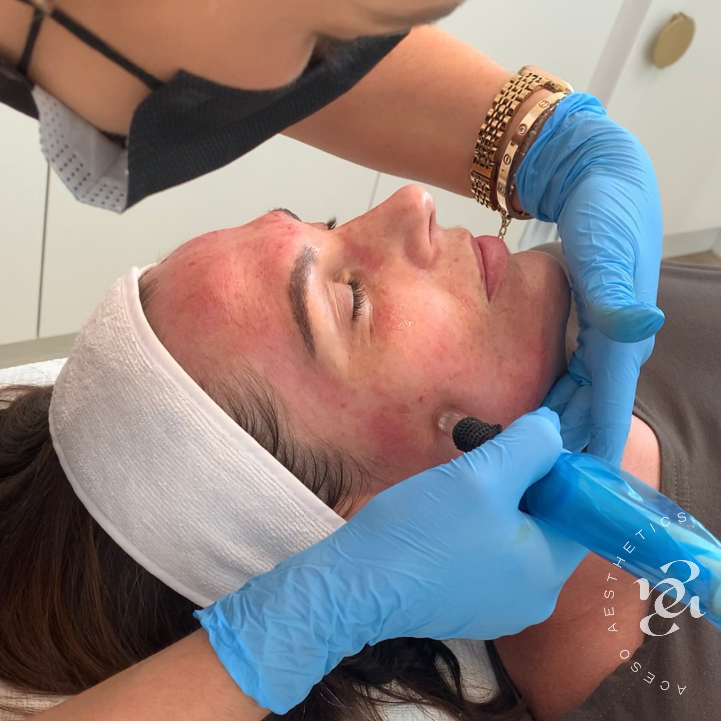 Facials Square post - with Aceso Logo - 17.PNG