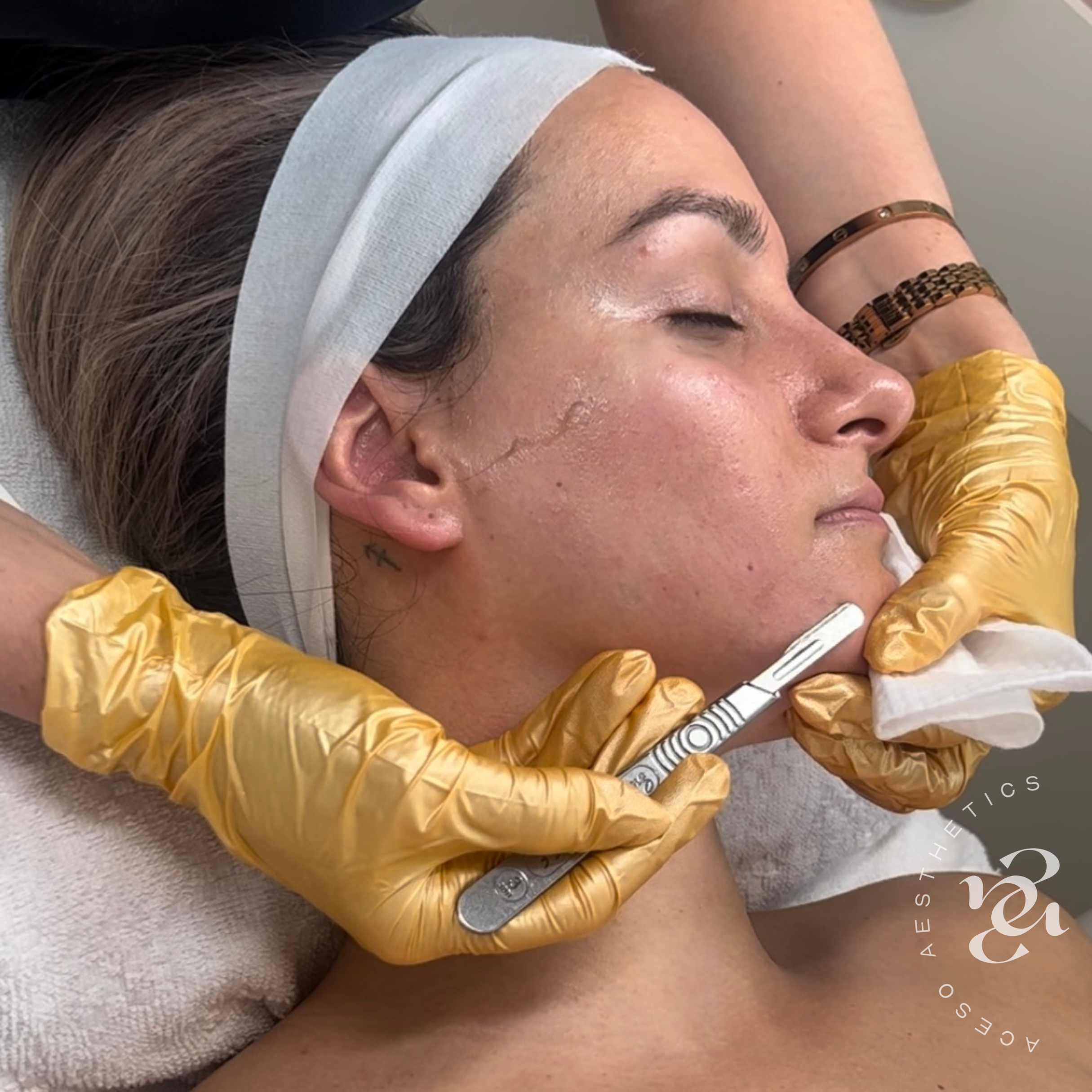 Facials Square post - with Aceso Logo - 12.PNG