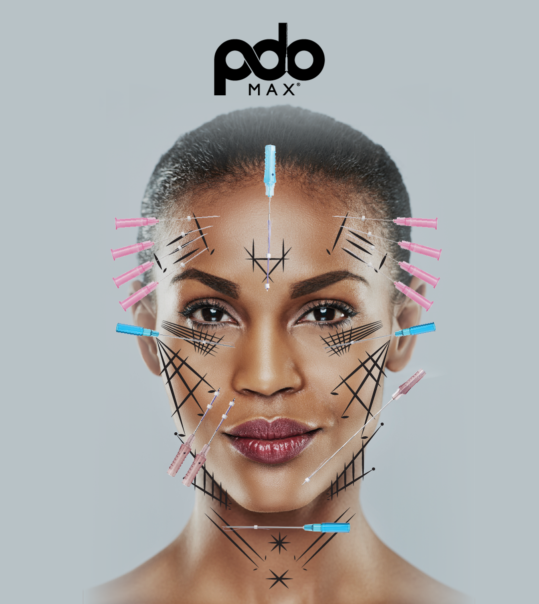 PDO Max® Threads - Lift, tighten, and contour — Exclusive Med Aesthetics