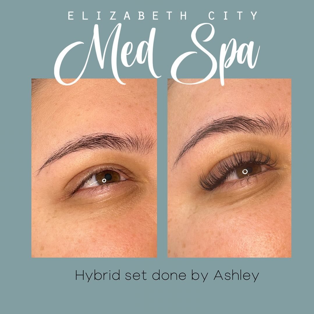 🔥Check out this amazing before and after hybrid set of lashes done by @lashesbyashleycole 
.
.
.
☎️(252)340-6155
💻 Link in our bio to book online
.
.
.
 #skincare #medspa #elizabethcitync #aesthetics #lashes #lashartist