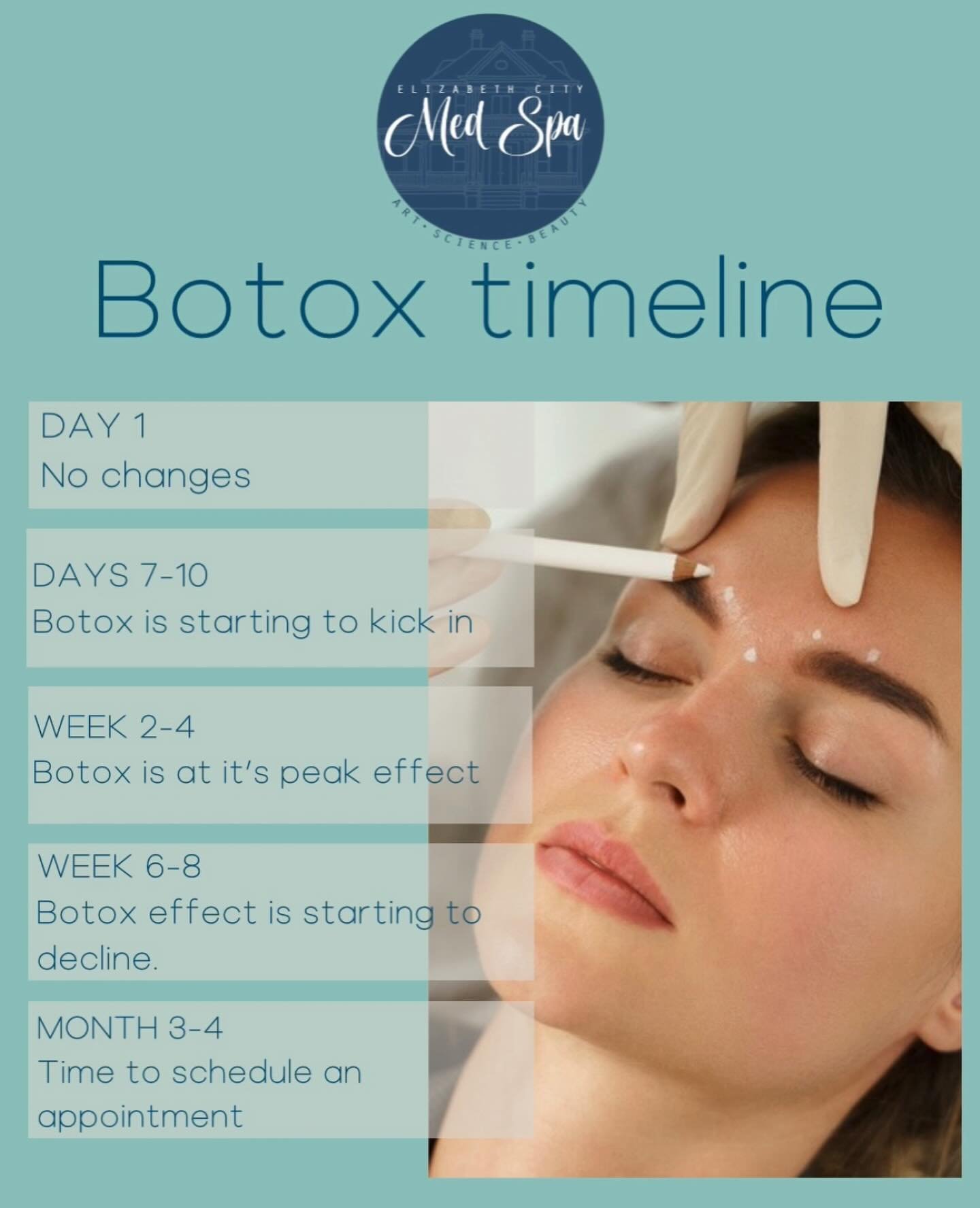 How long does Botox last? This is what you can expect from your neurotoxin! And don&rsquo;t forget that duration is directly correlated with dosing. 
#botoxcosmetic #dysport #neurotoxin #medspanc #elizabethcitync