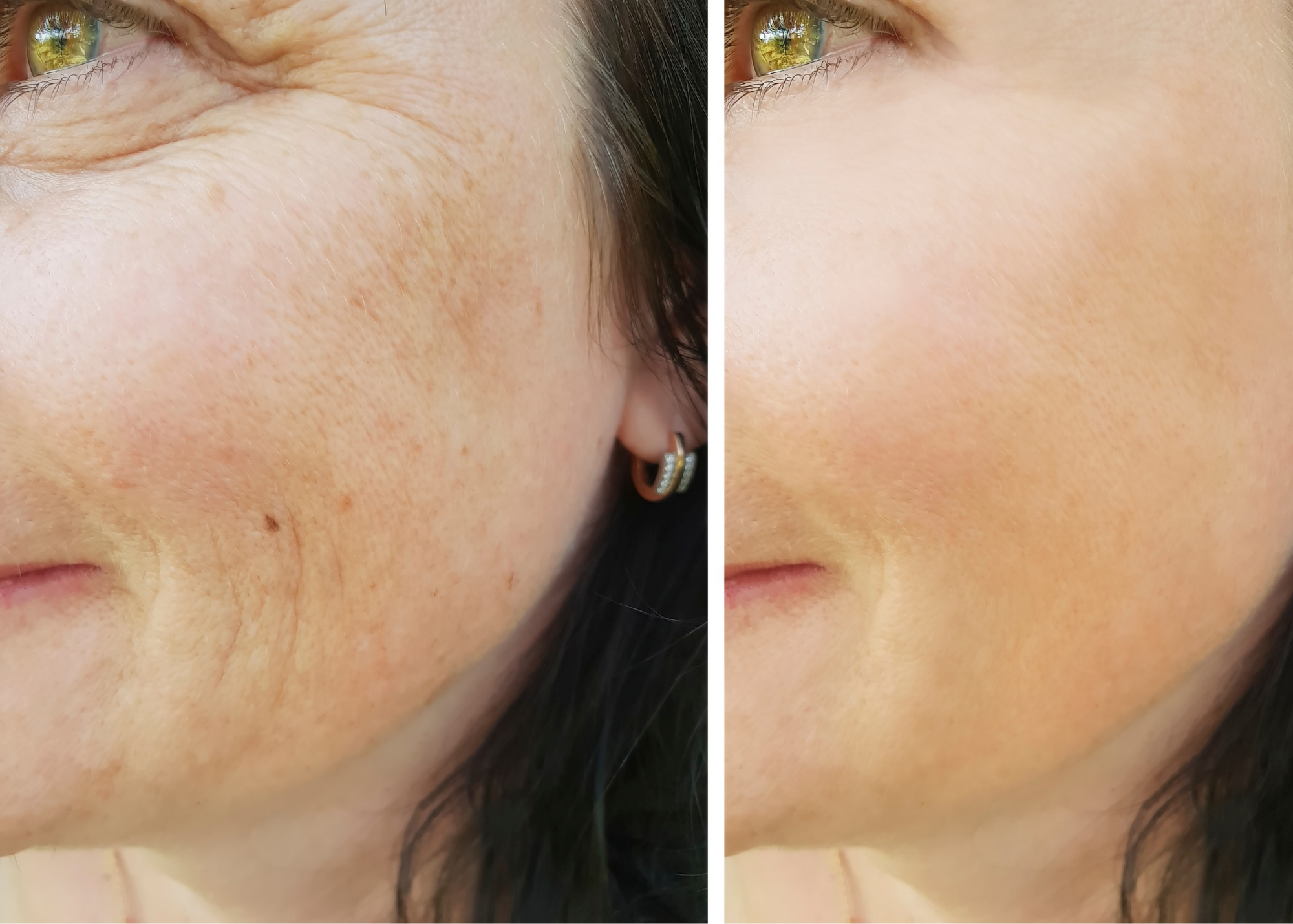 How do I firm my skin naturally?