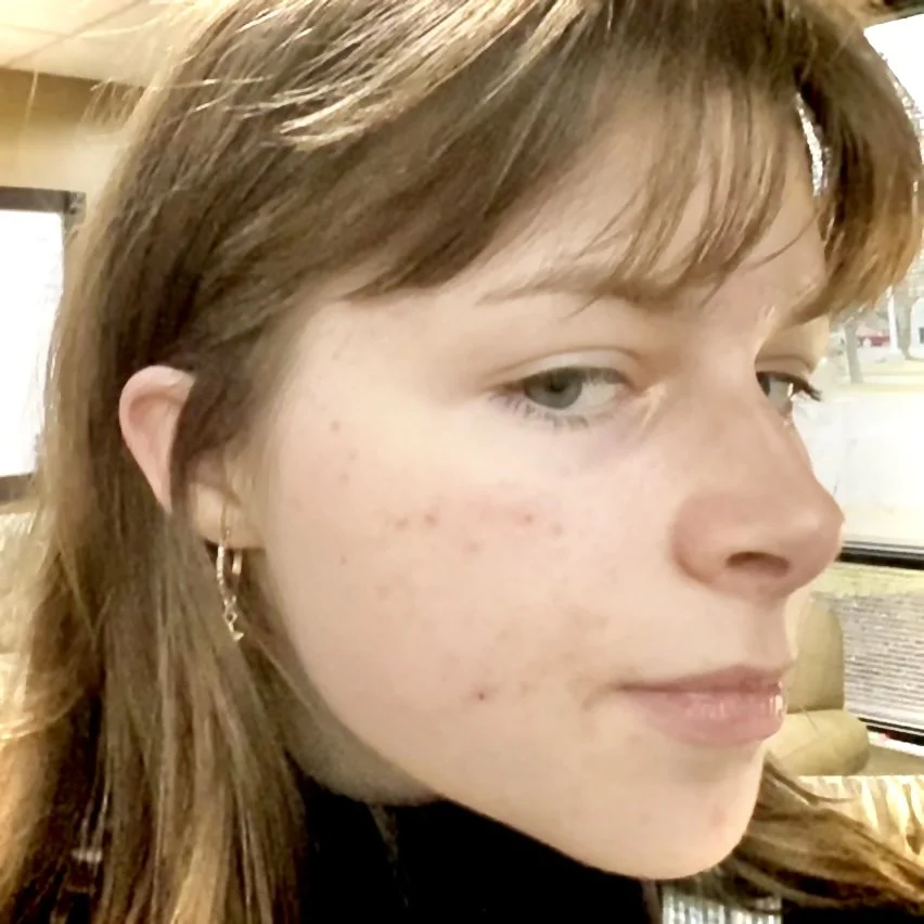 Close-up of a young woman with light skin, reddish-brown hair, and blue eyes, looking to the side indoors.