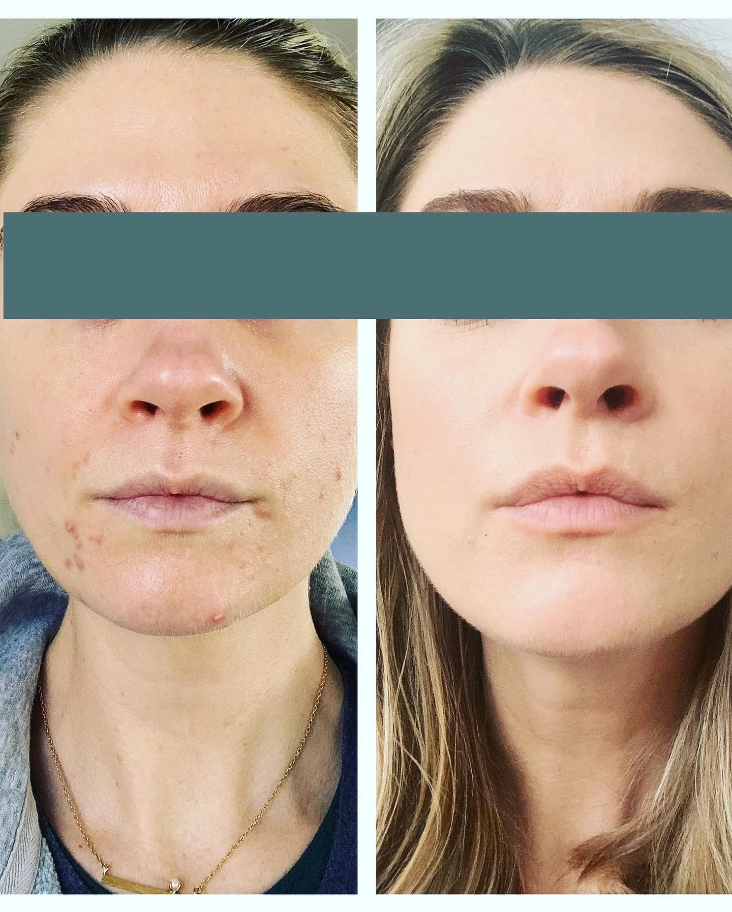 Best organic vegan skincare for aging, acne-prone, and sensitive skin—reduces wrinkles, fades sun spots, clears breakouts, and restores the skin barrier