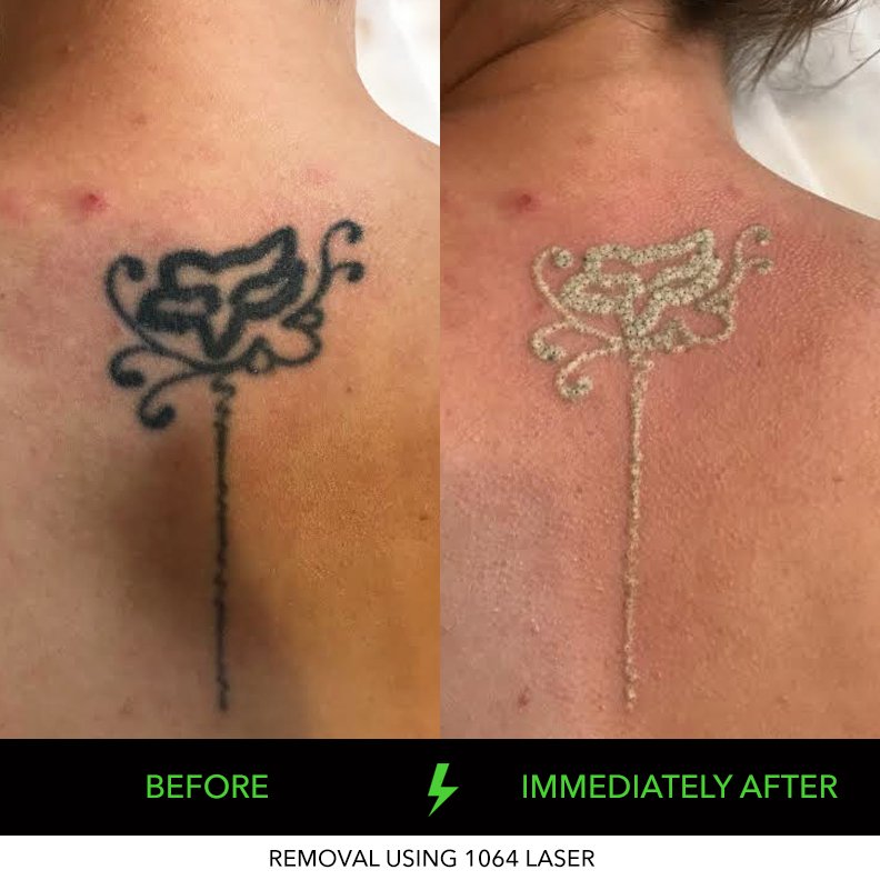 brompton back tatoo