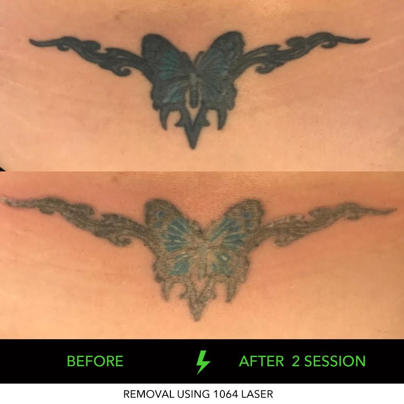 lower back tattoo adelaide