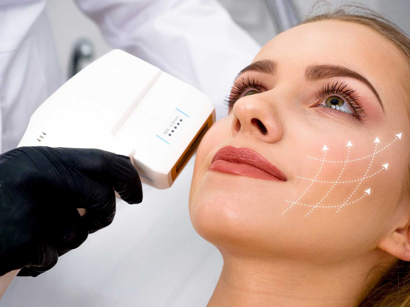 HIFU (High Intensity Focused Ultrasound) — NAS BEAUTY — NAS BEAUTY