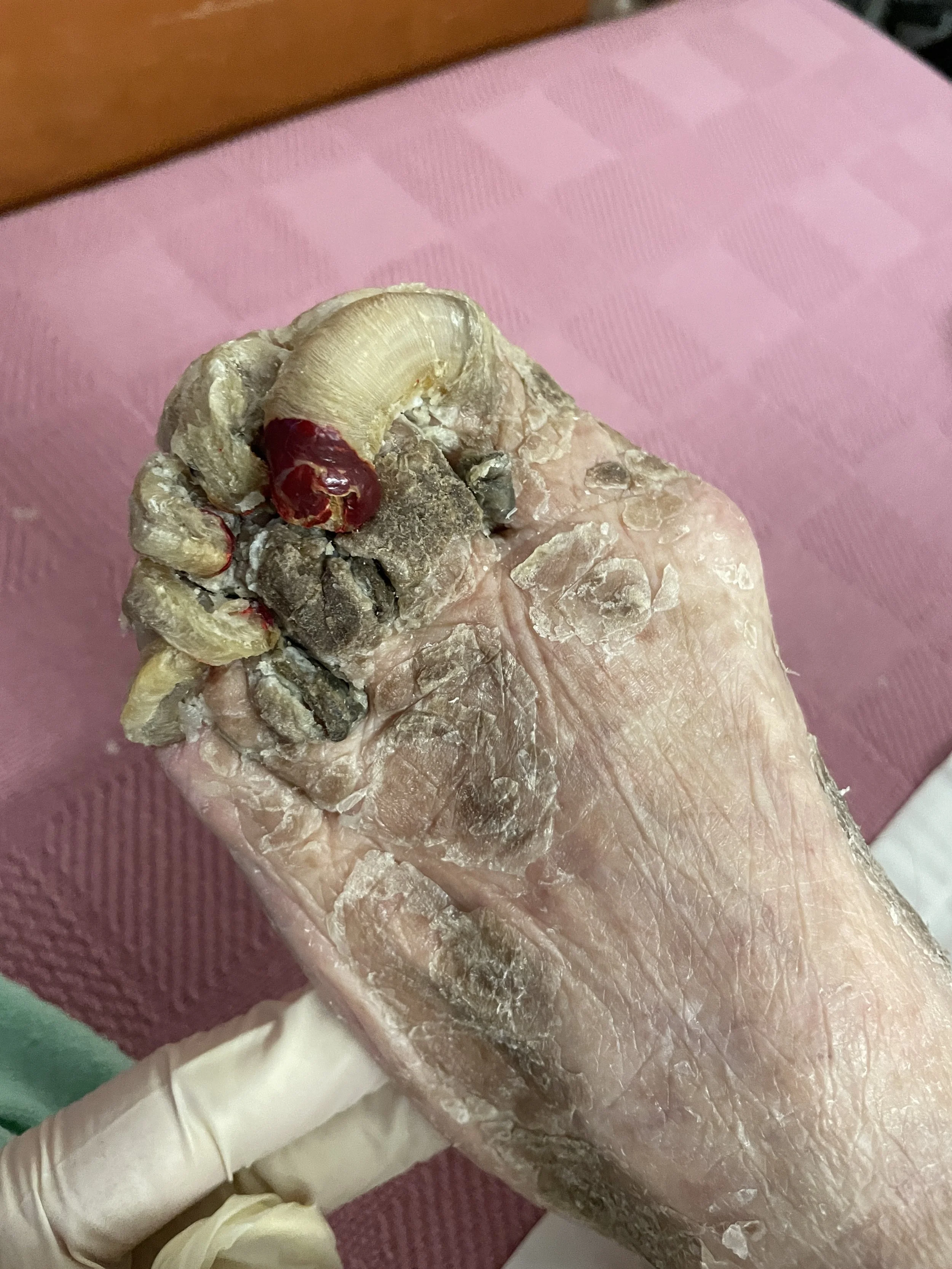 A close-up of a person's hand with dry, cracked skin, holding a dried insect, possibly a beetle or a similar type, with a large, curved horn on its head. The hand appears to be covered in a powdery substance.