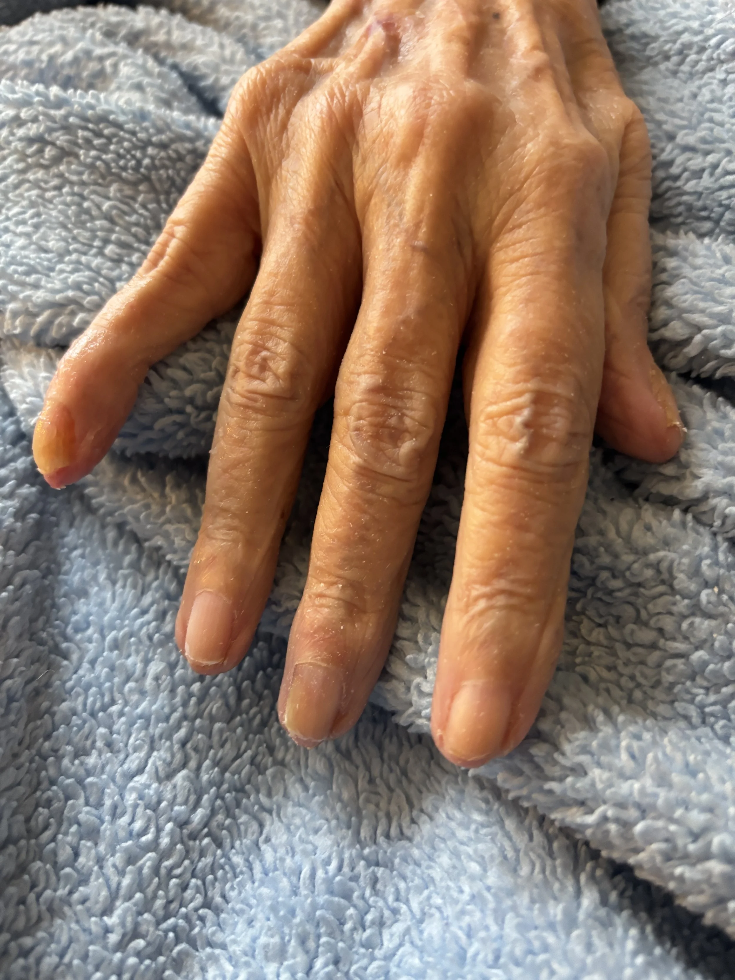 Fingernail add on after