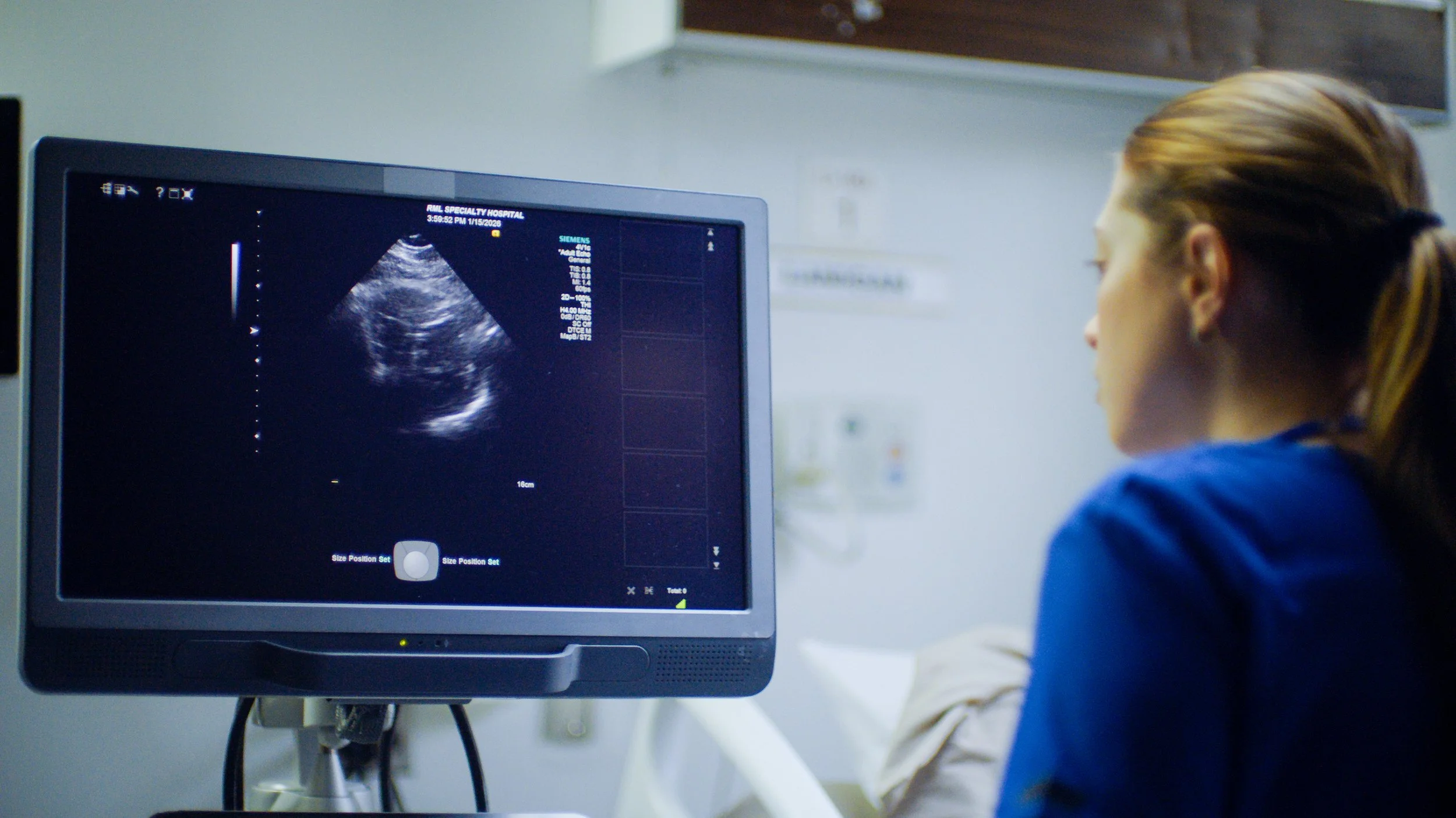 Echocardiogram.jpg