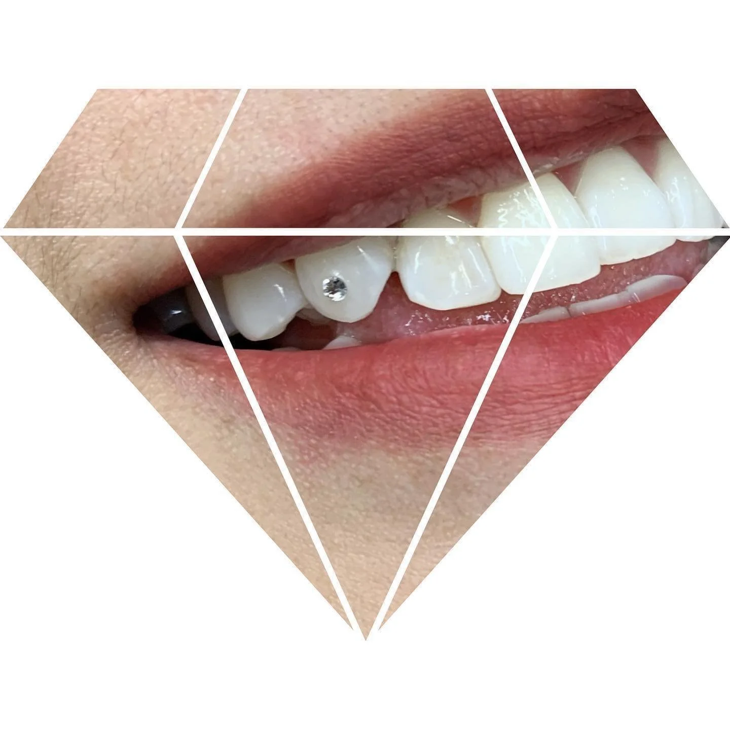 Tooth Gem — VIP Eyebrows