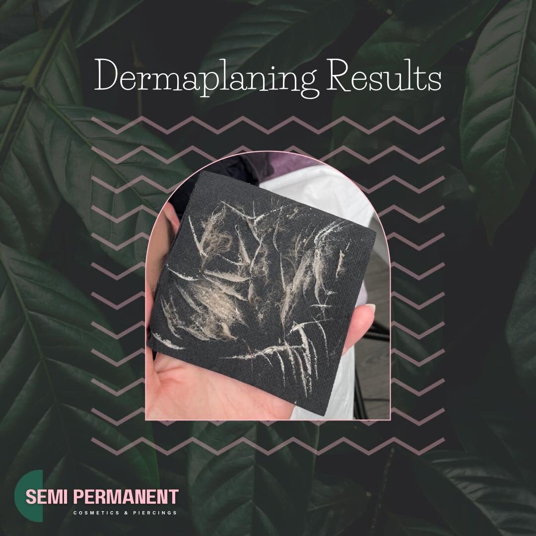 So satisfying removing all this crap from peoples faces 😂 

#dermaplaning #babysoftskin #exfoliate #deepexfoliation #removespeachfuzz #PeachFuzz #hairremoval #motherdaytreat #deal #offer #bargin #cardiffbeautyclinic #cardiffbeauty #friendlysalon #go