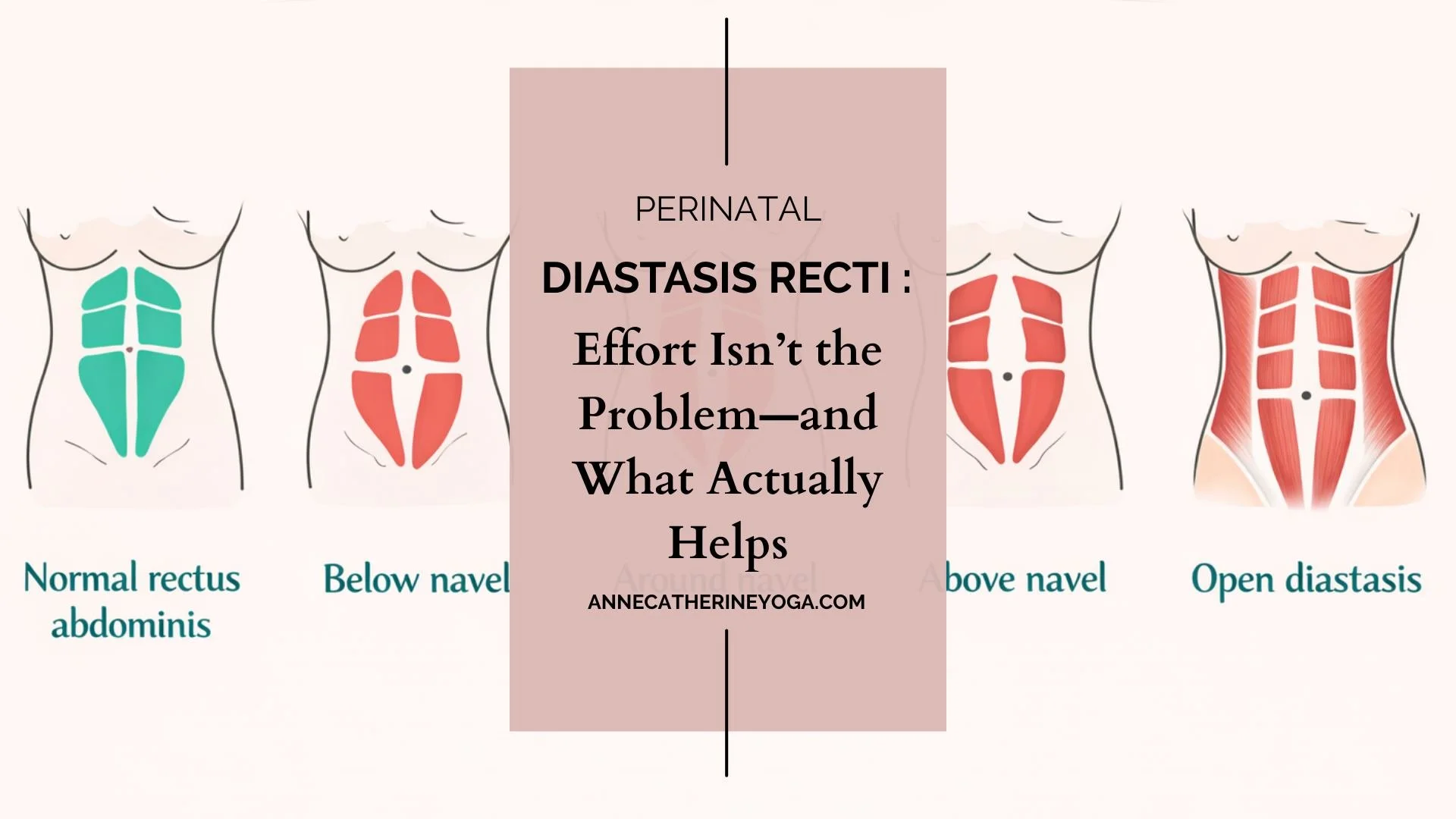 If you&rsquo;ve tried all the ab exercises&hellip;
If you&rsquo;ve gone to yoga classes and really tried to &ldquo;engage your core&rdquo;&hellip;
If you&rsquo;ve followed the YouTube videos and postpartum programs&hellip;

&hellip;and your diastasis